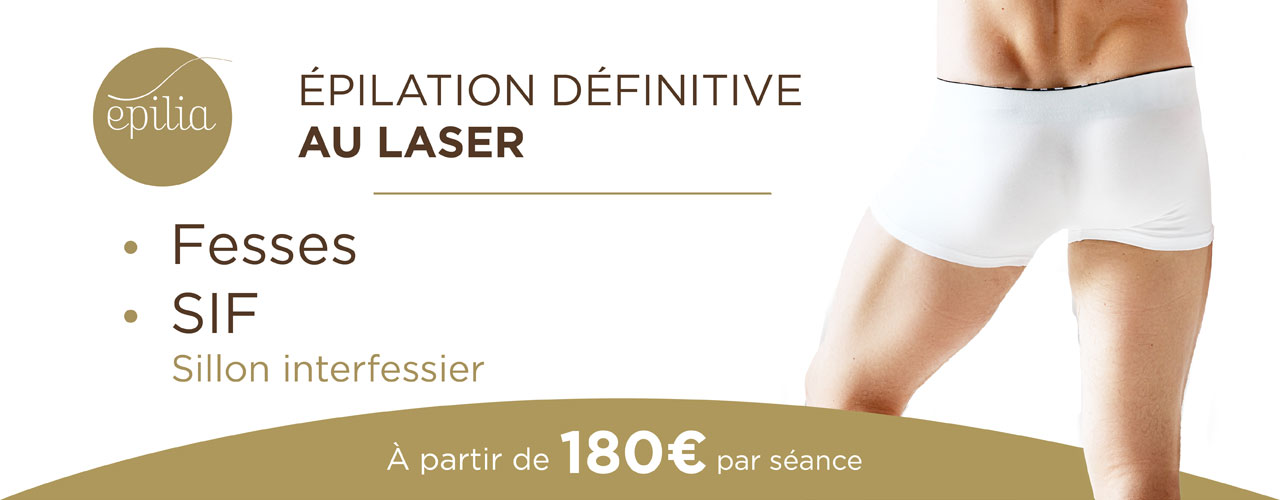 epilation-laser-femmes-sif-homme-wavre
